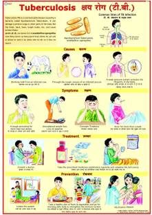 Tuberculosis Chart (TB) Photographic Paper