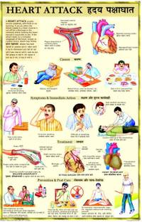 Heart Attack Chart Photographic Paper