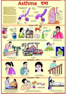 Asthma Chart Photographic Paper