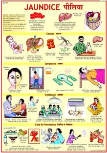 Jaundice Chart Photographic Paper
