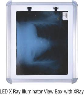 Thermocare LED BOX X-Ray Viewer
