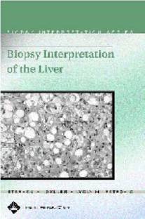 Biopsy Interpretation of the Liver