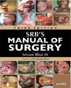 SRB's Manual of Surgery