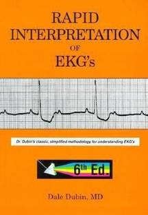 Rapid Interpretation of EKG's