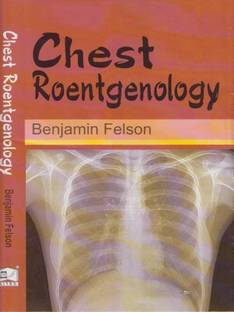 Chest Roentgenology