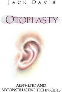 Otoplasty