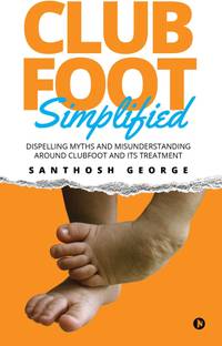 Clubfoot Simplified  - Dispelling Myths and Misunderstanding around Clubfoot and its treatment