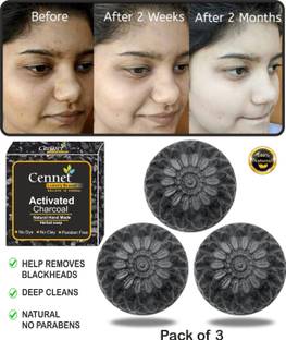 CENNET Activated Charcoal Soap For Women Skin Whitening , Pimples, Blackheads , Acne, Natural Detox Face & Body Soap