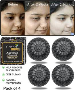 CENNET Activated Charcoal Soap For Women Skin Whitening , Pimples, Blackheads , Acne, Natural Detox Face & Body Soap