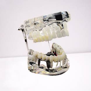 pyrax Dental implants, Crown and bridge, Implant-supported bridge, Tooth Dental Elevator