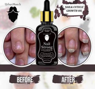 UrbanMooch Premium Nail & Cuticle Growth Oil- For Nail Growth, Repair & Cuticle Care For Men & Women- Yellow