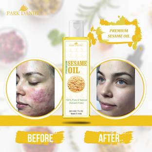 PARK DANIEL Virgin Sesame Oil- Pure and Natural (100 ml)