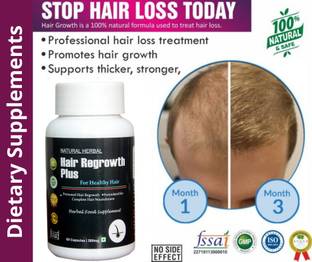 natura herbal Hair Growth Capsules-for Hair Strength & Quality, Controls Hairfall, All Hair Loss