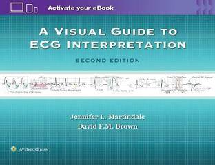 A Visual Guide to ECG Interpretation