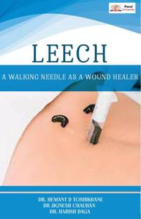 LEECH – A WALKING NEEDLE AS A WOUND HEALER