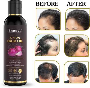 eneeva Onion Hair Oil - Controls Hair Fall - NO Mineral Oil, Silicones, 100 ML Hair Oil