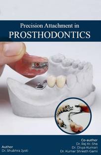 PRECISION ATTACHMENT IN PROSTHODONTICS Volume1