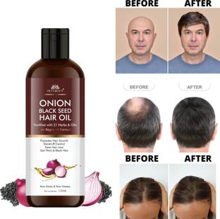 INTIMIFY Onion Black Seed Hair Oil For Hair Growth, Dandruff Control & Anti hair fall Hair Oil