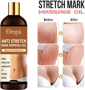 Oraya Stretch Oil for Stretch Marks Removal Post Pregnancy fast work-