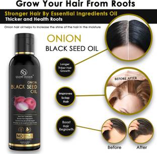 glowocean Onion Blackseed oil For Hair Fall Control, Hair Growth & Hair Regrowth Hair Oil