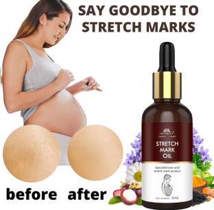 INTIMIFY Pregnancy Stretch Mark Removal Oil Cream For Women, Scar Removal, Anti Wrinkle Women