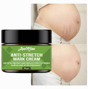 AroMine Stretch Marks Cream | Reduces Marks & Scars |Post Pregnancy Marks For Women-