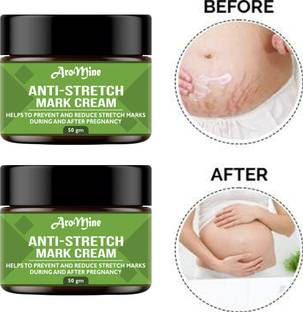 AroMine Anti Stretch Marks Cream to Reduce Stretch Marks & Scars-50gm-2-Jar-