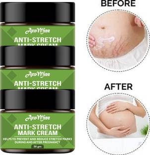 AroMine Anti- Stretch Mark Massage Cream For a Body Scars Removal Cream- 50gm-3-Jar Women