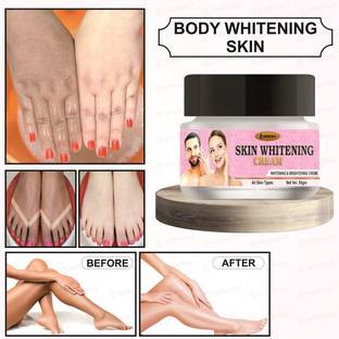 Rosevely Skin Whitening Day & Night Cream For Men & Women (50 gm)