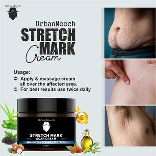 UrbanMooch Stretch Marks Cream for Reducing Stretch Marks & Scars for Men-