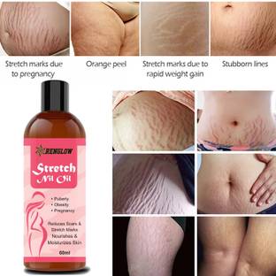 RENGLOW Stretch Marks Scar removal oil cream during after pregnancy delivery Bio Oil