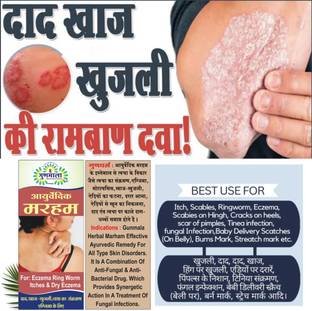 Gunmala eczema or leucoderma ointment, for ringworm & effective vitiligo treatment