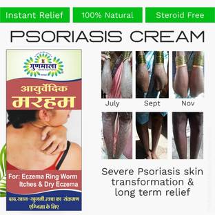 Gunmala Ringworm Ointment / Ayurvedic Marham, For Effective Treatment Eczema & Red Rash