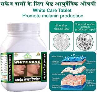 Gunmala Enterprises safed daag ki dawa | white care tablet - 60 Tab.