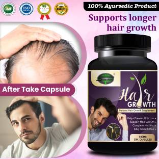 Sabates Hair Growth | Ayurvedic Capsule Shiny Hair with Aloe Vera Promotes Hair Gain