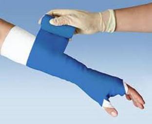 kiyan Fiber Glass Casting Tape 10CM X 3.6 Mtr Crepe Bandage