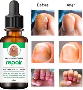 partien nail growth oil/nail growth serum Nail Treatment Repair Gel (60 ml) Men (60 ml) Men & Women