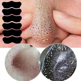 house of common Paper Blackhead Remover Strips