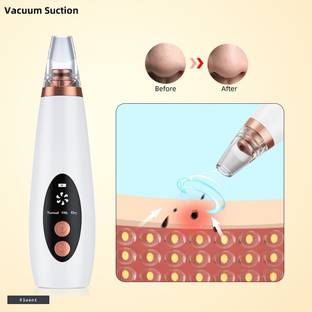 Fluent Plastic Blackhead Remover Vacuum Suction Device