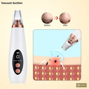 FURESTA Plastic Blackhead Remover Vacuum Suction Device