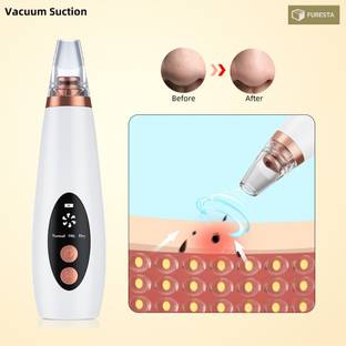 FURESTA Plastic Blackhead Remover Vacuum Suction Device