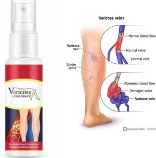 PHIZLLER Instant Relief Varicose Vein Spray Treatment for Legs, Veins Miracle Spray Spray