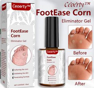 Prefetto COSMO Footease Corn Eliminator Gel