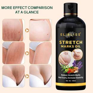 ELIBLISS Stretch Mark Oil for Remove Hyperpigmentation, anti-Cellulite, remover scars