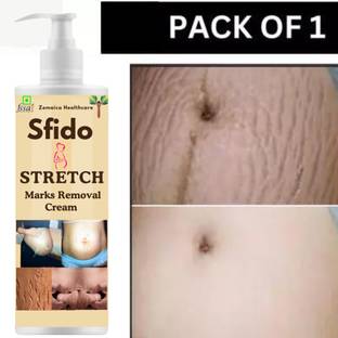 Zemaica Healthcare Sfido Stretch Marks cream to Reduce Stretch Marks & Scars