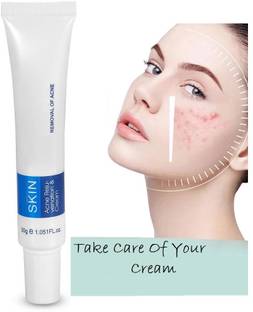 WOONGMI Moisturizing Oil Control Acne Remover Cream For Girls And Mans