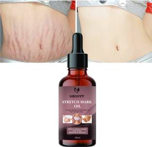 Groovy Repair Stretch Marks Removal - Natural Heal Pregnancy Breast, Mark oil 40 ml