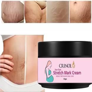 crinol Stretch Marks Scar removal cream 4 Hyperpigmentation,remover scars [50ml]