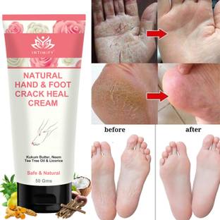 INTIMIFY Hand & Foot Crack Remover Cream For Women & Men 50 g