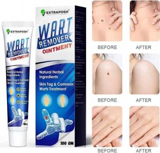 kHUDAt brat Warts Remover Cream Extract Skin Face Extract Corn (Prague)